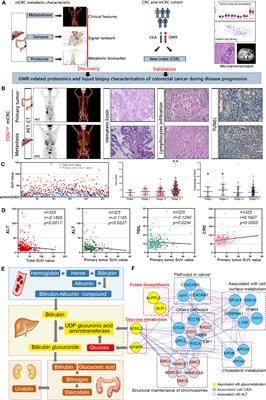 Multi-omics analyses of glucose metabolic reprogramming in colorectal cancer